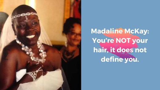 June 2025 Surthrivor: You are not your hair: Madaline McKay
