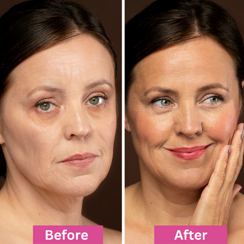 Side-by-side photos of a middle-aged woman. The left image, labeled Before, shows duller skin with wrinkles. The right image, labeled After, shows her with smoother, brighter skin, smiling and touching her cheek.