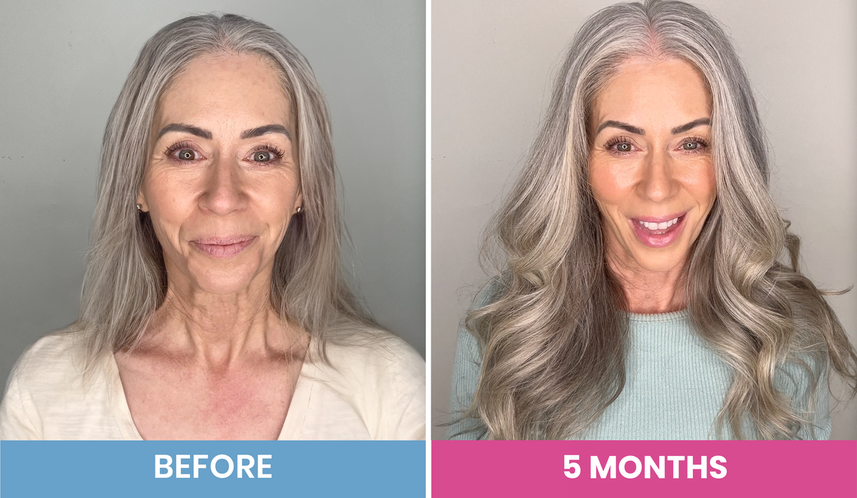 Side-by-side comparison of a woman with long gray hair. Left image labeled BEFORE shows her with straight hair and a neutral expression. Right image labeled 5 MONTHS shows her with styled, wavy hair and a bright smile.