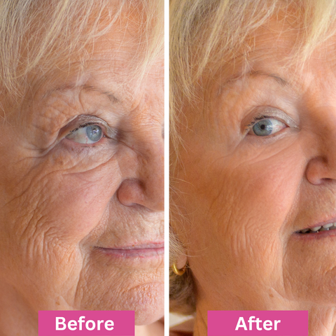 Split image of an older woman’s face showing “Before” on the left with more visible wrinkles and “After” on the right with smoother skin, illustrating a skincare or anti-aging product effect.