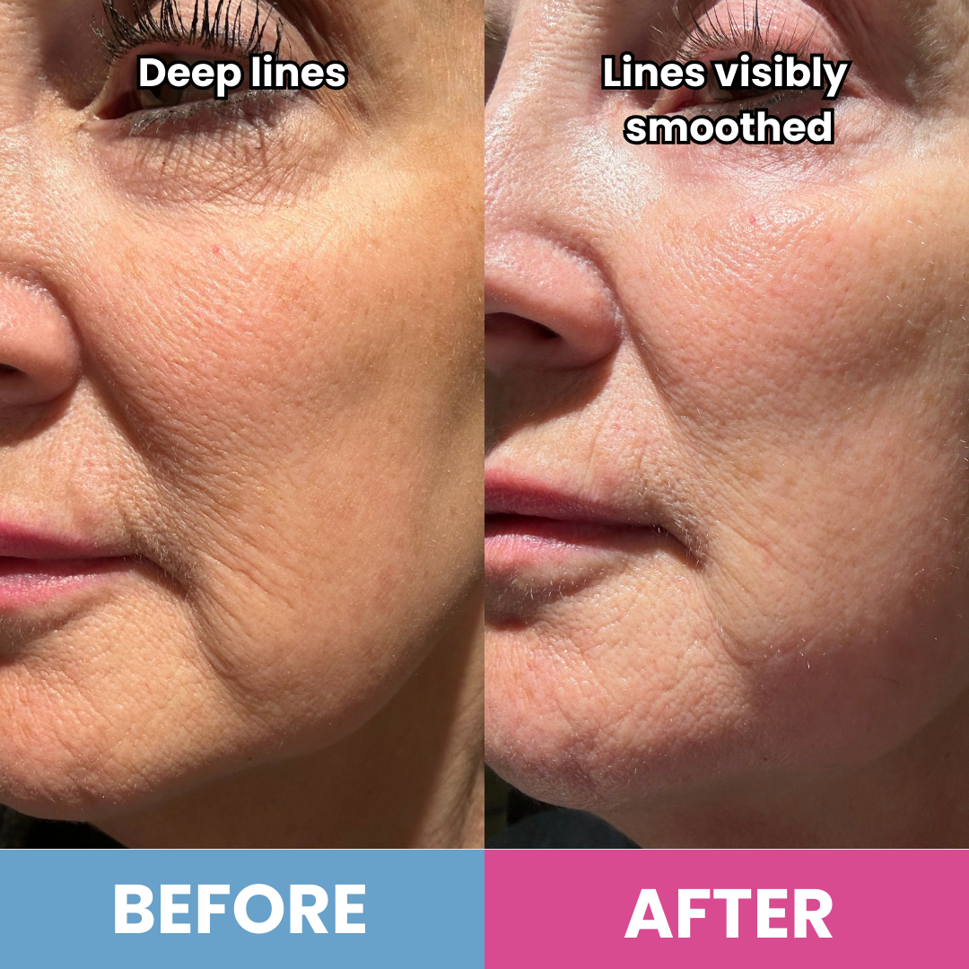 Side-by-side close-up of a woman’s face: left with deep lines, right with smoother skin after using PrimeSkin Magic Repair Serum + PrimeEyes Hydrate from PrimePrometics™. Text: “BEFORE” and “AFTER.”.