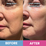 Side-by-side close-up of a woman’s face: left with deep lines, right with smoother skin after using PrimeSkin Magic Repair Serum + PrimeEyes Hydrate from PrimePrometics™. Text: “BEFORE” and “AFTER.”.