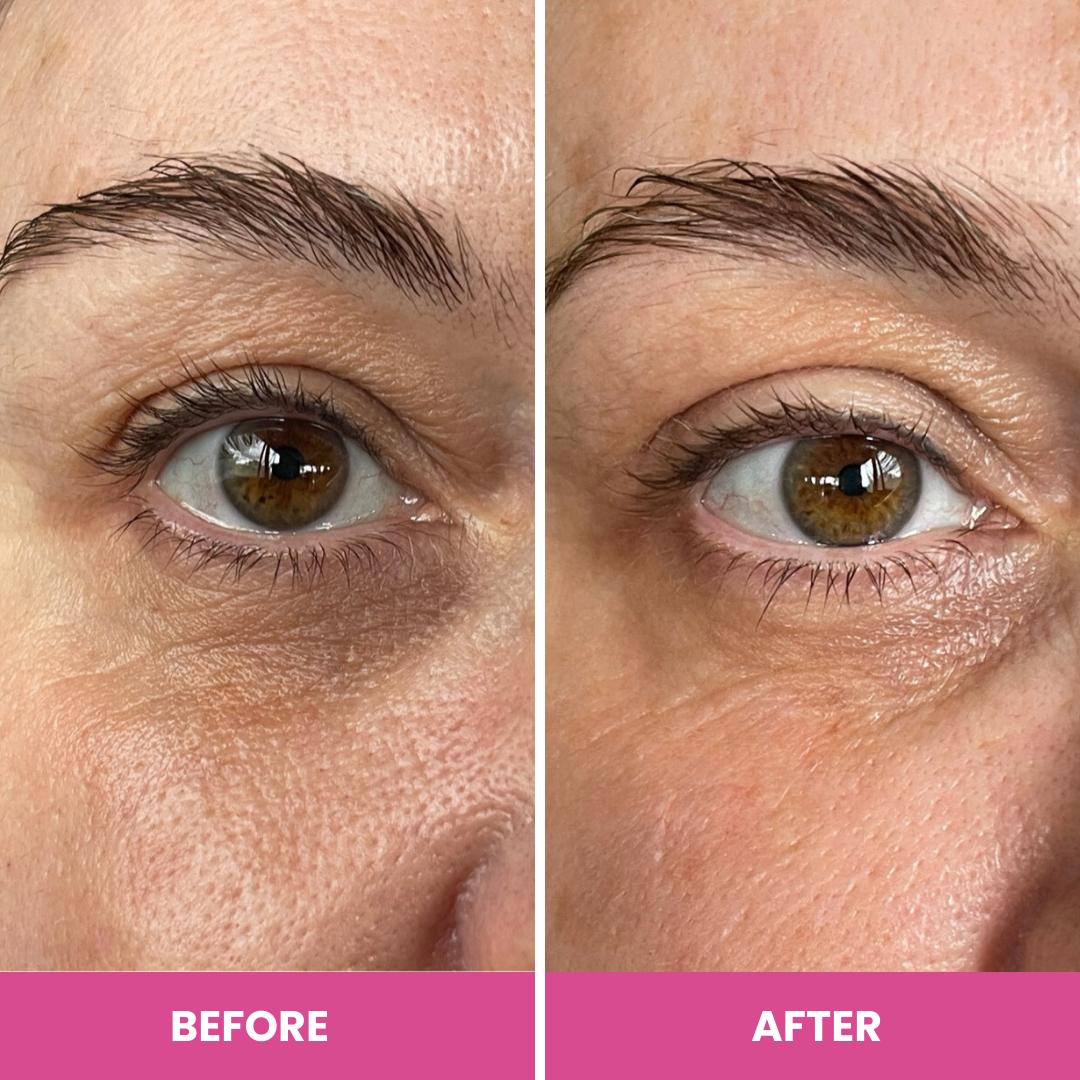 Before-and-after close-up showing under-eye fine lines and crows feet visibly smoothed after using Prime Prometics PrimeEyes Hydrate