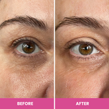 Before-and-after close-up showing under-eye fine lines and crows feet visibly smoothed after using Prime Prometics PrimeEyes Hydrate