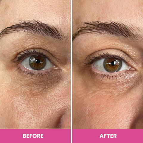 Before-and-after close-up showing under-eye fine lines and crows feet visibly smoothed after using Prime Prometics PrimeEyes Hydrate