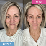 Before-and-after of a woman over 50 with more even-toned, brighter skin after using Prime Prometics PrimeEyes Hydrate
