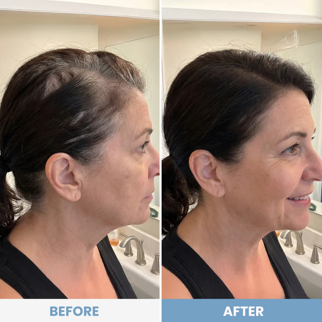 Side-by-side photos of a woman in a bathroom. The left image shows thinning hair; the right image reveals fuller, healthier hair, thanks to instant coverage from PrimePrometics™ Instant Confidence Duo hairline powder, highlighting the dramatic before-and-after results of this transformative treatment.