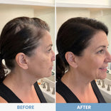 Side-by-side photos of a woman in a bathroom. The left image shows thinning hair; the right image reveals fuller, healthier hair, thanks to instant coverage from PrimePrometics™ Instant Confidence Duo hairline powder, highlighting the dramatic before-and-after results of this transformative treatment.