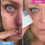 Before-and-after showing reduced dark under-eye circles after applying Prime Prometics PrimeEyes Hydrate