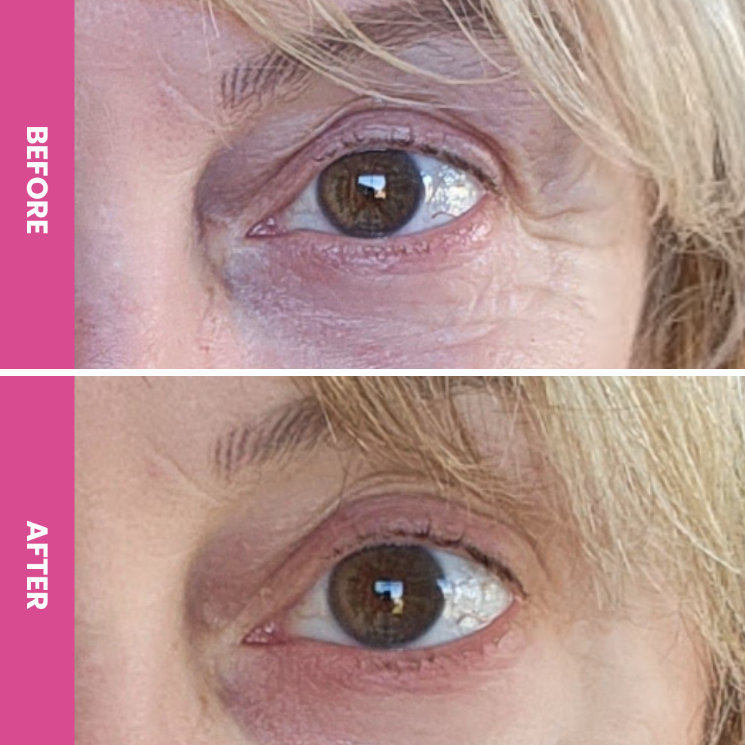 Side-by-side images of a person’s eye area labeled Before and After show reduced wrinkles and smoother skin after using PrimePrometics™ PrimeSkin Magic Repair Serum + PrimeEyes Hydrate.