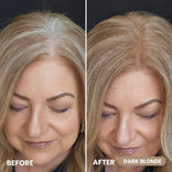 Dark blonde before and after demonstrating natural-looking hairline coverage with Hairline Powder