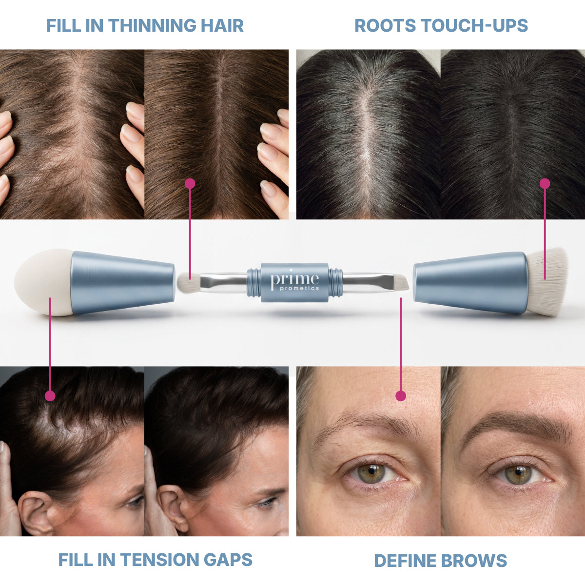Introducing the PrimePrometics™ 4-in-1 Hairline Powder Brush—a dual-ended beauty tool with cruelty-free bristles designed for filling thinning hair, touching up roots, concealing tension gaps, and defining brows. As demonstrated in detailed before-and-after close-up photos, this versatile applicator ensures precise application and flawless results.