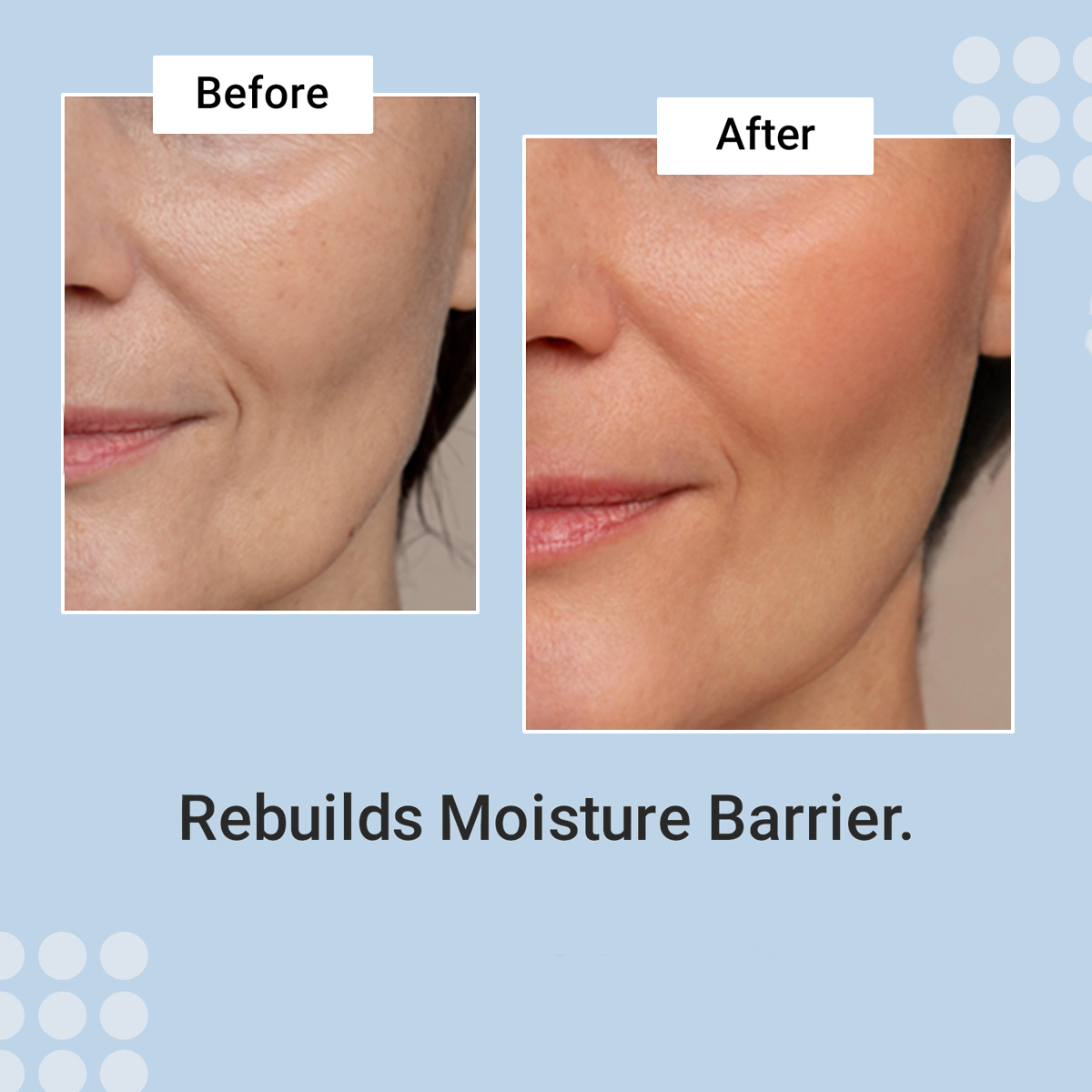 Before-and-after of mature cheek skin showing rebuilt moisture barrier after using Prime Prometics PrimeWand Nourish
