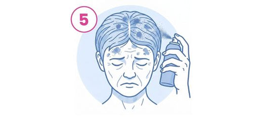 Illustration einer Person, die ein Medikament oder ein Behandlungsmittel auf ihre Kopfhaut sprüht und dabei mehrere Stellen auf der Kopfhaut und der Stirn behandelt; oben links ist eine 5 in einem rosa Kreis zu sehen.