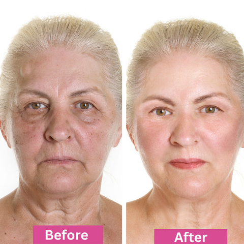 Side-by-side photos of an older woman with light hair. Left image labeled Before shows more wrinkles and uneven skin tone. Right image labeled After shows smoother skin and a brighter, more even complexion.
