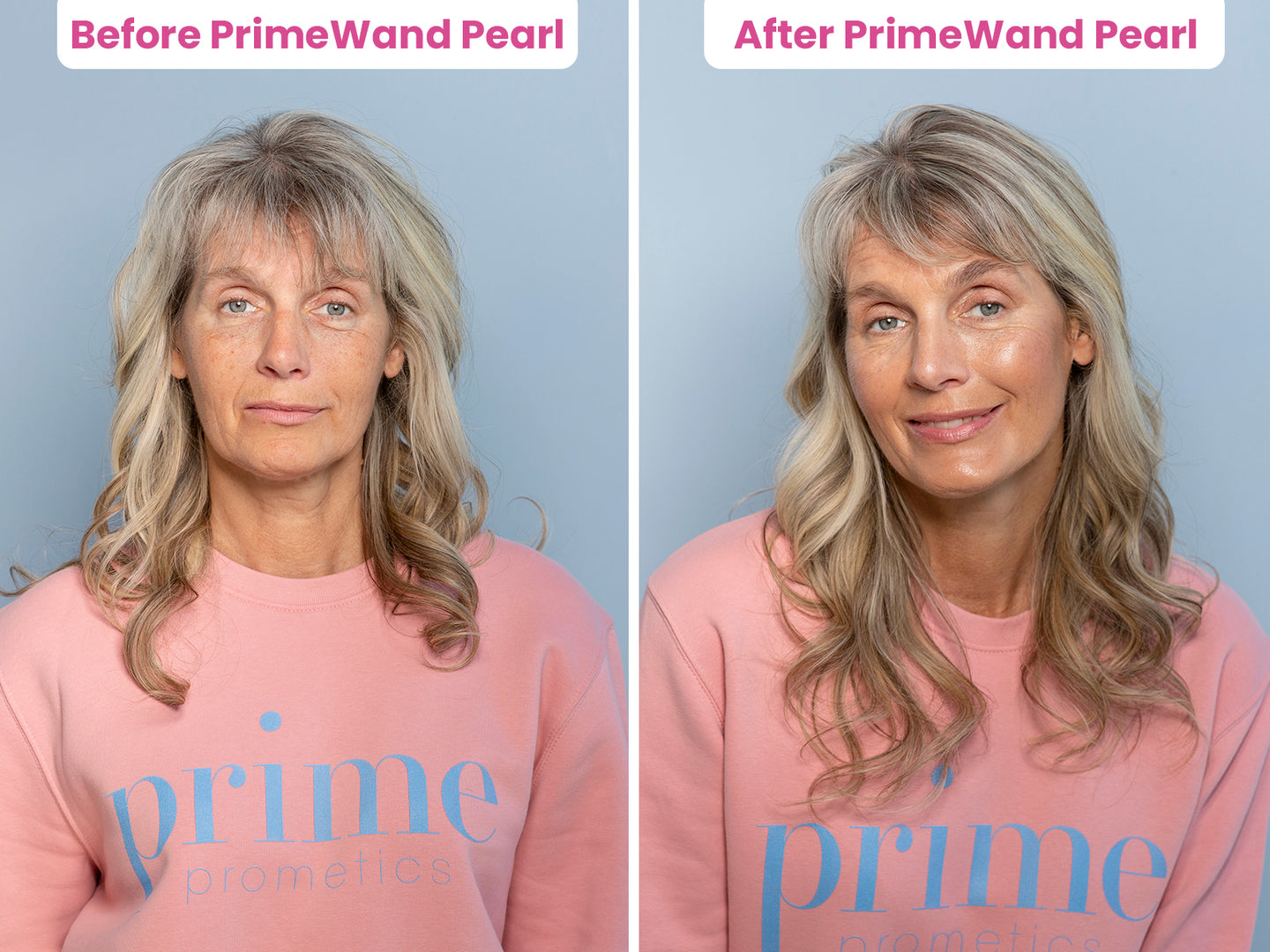 Before-and-after of a mature blonde woman showing a soft, glowing complexion after using Prime Prometics PrimeWand Pearl