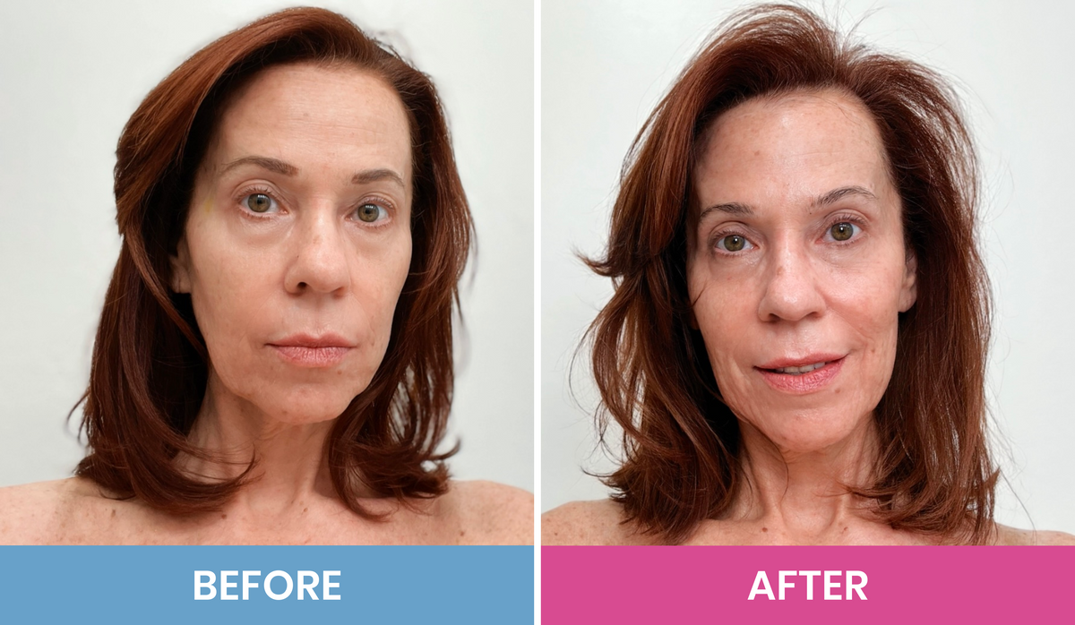 A woman with shoulder-length reddish-brown hair is shown in two side-by-side photos labeled Before and After. In the After image, her complexion appears brighter and her expression more relaxed.