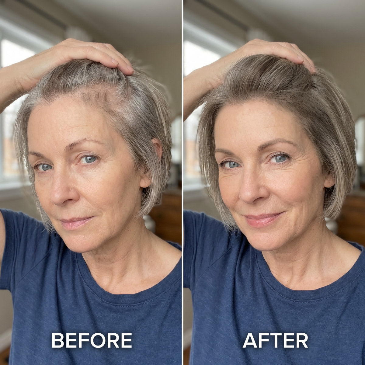 Geteiltes Bild einer älteren Frau mit kurzen grauen Haaren; die linke Seite mit der Beschriftung „VORHER“ zeigt schütteres Haar, die rechte Seite mit der Beschriftung „NACHHER“ zeigt volleres Haar und ein leichtes Lächeln.