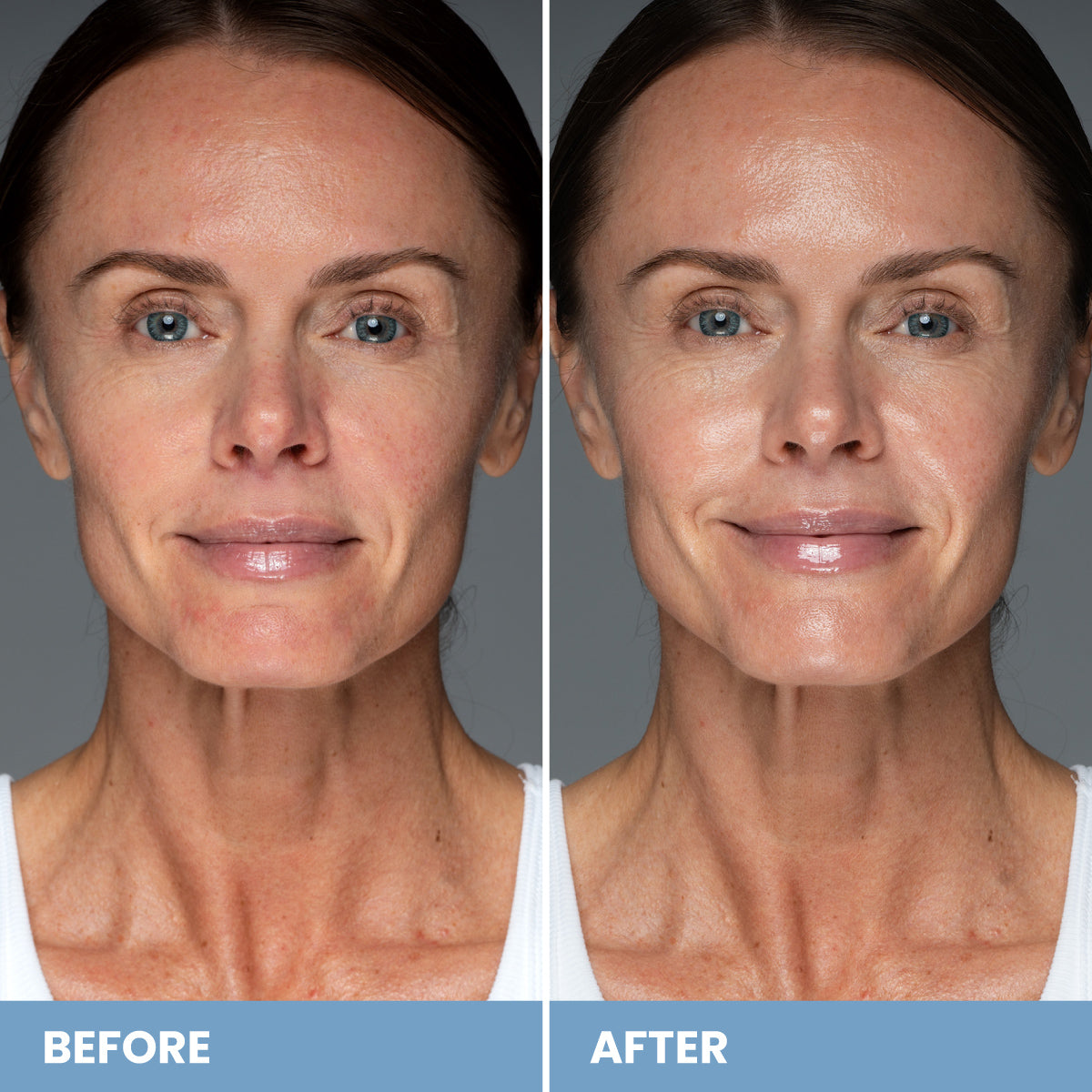 Side-by-side photos of a woman’s face labeled “Before” and “After.” In the “After” image, her skin appears smoother, more radiant, and with fewer visible wrinkles compared to the “Before” image.