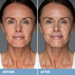 Before-and-after of mature skin looking calmer with reduced redness and smoother texture after using Prime Prometics Gentle Gel Cleanser