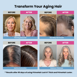 Transform Your Aging Hair: four before-and-after results after 90 days using PrimeHair Lush N' Thick and PrimeHair Luster—thinning hair, new baby hair growth, hairline restoration, and volume and thickness