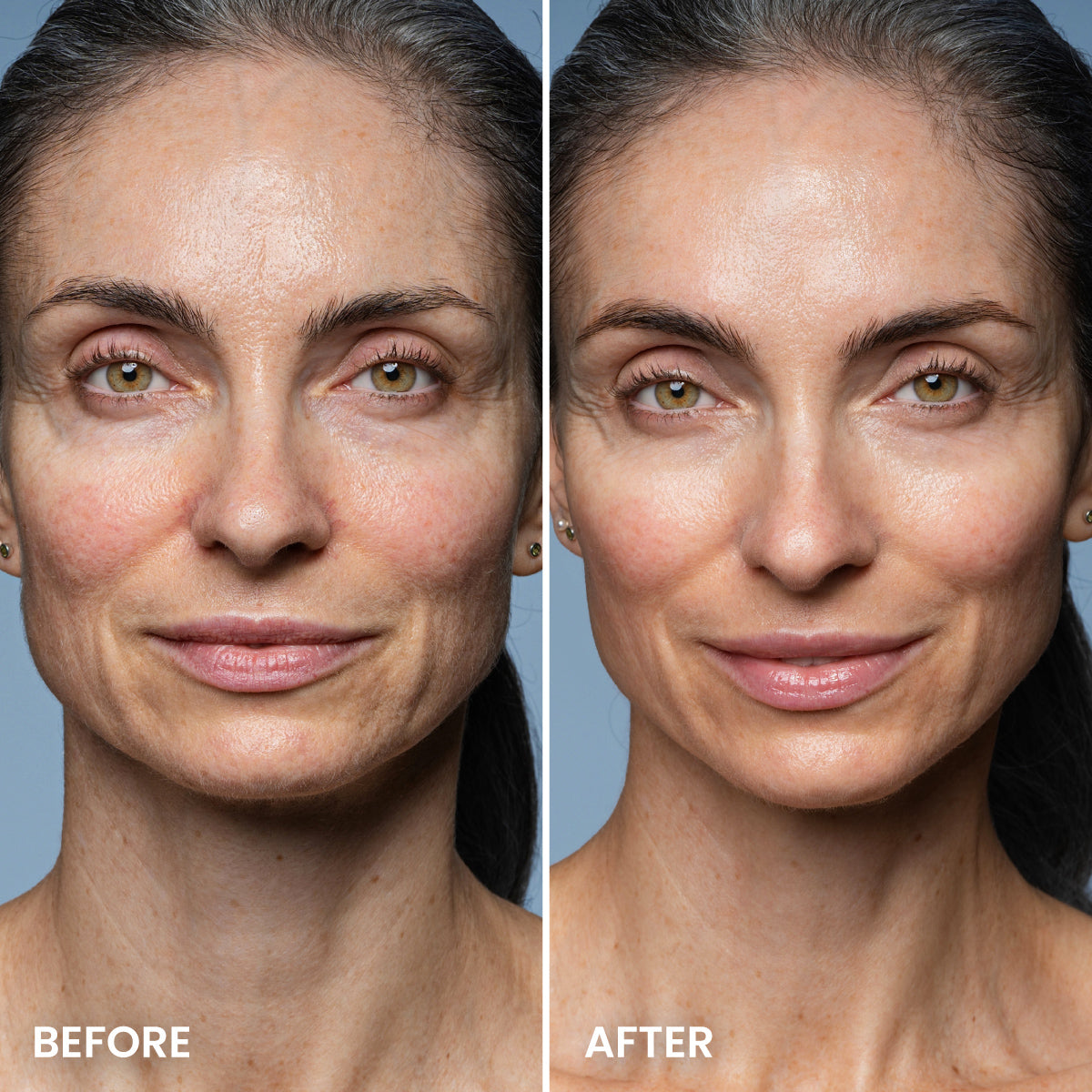 Side-by-side close-up of a woman’s face labeled Before and After. The After side reveals smoother, more even-toned mature skin with reduced lines and blemishes, showcasing the rejuvenating effects of overnight hydration with PrimePrometics™ Pro-Collagen Peptide Firming Mask.