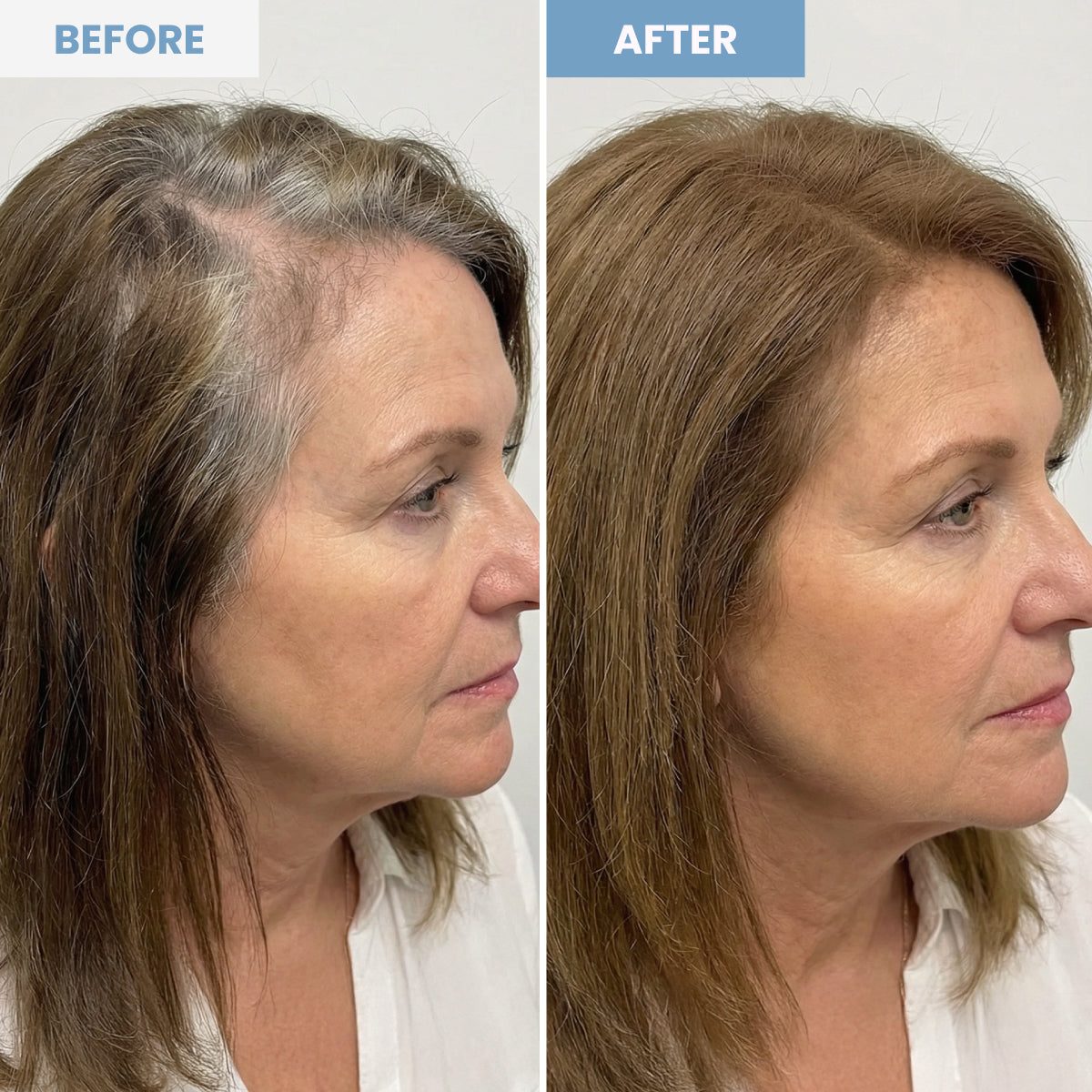 Side-by-side photos of a woman before and after hair coloring; the left shows visible gray roots, while the right shows uniform brown hair with no grays visible. Both images are from the same angle.