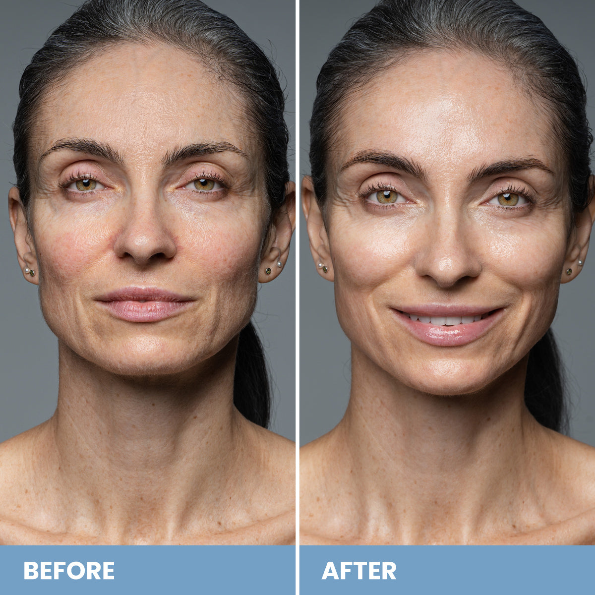 Prime Prometics Miracle Cream open jar, a barrier-supporting moisturizer for mature and menopausal skin