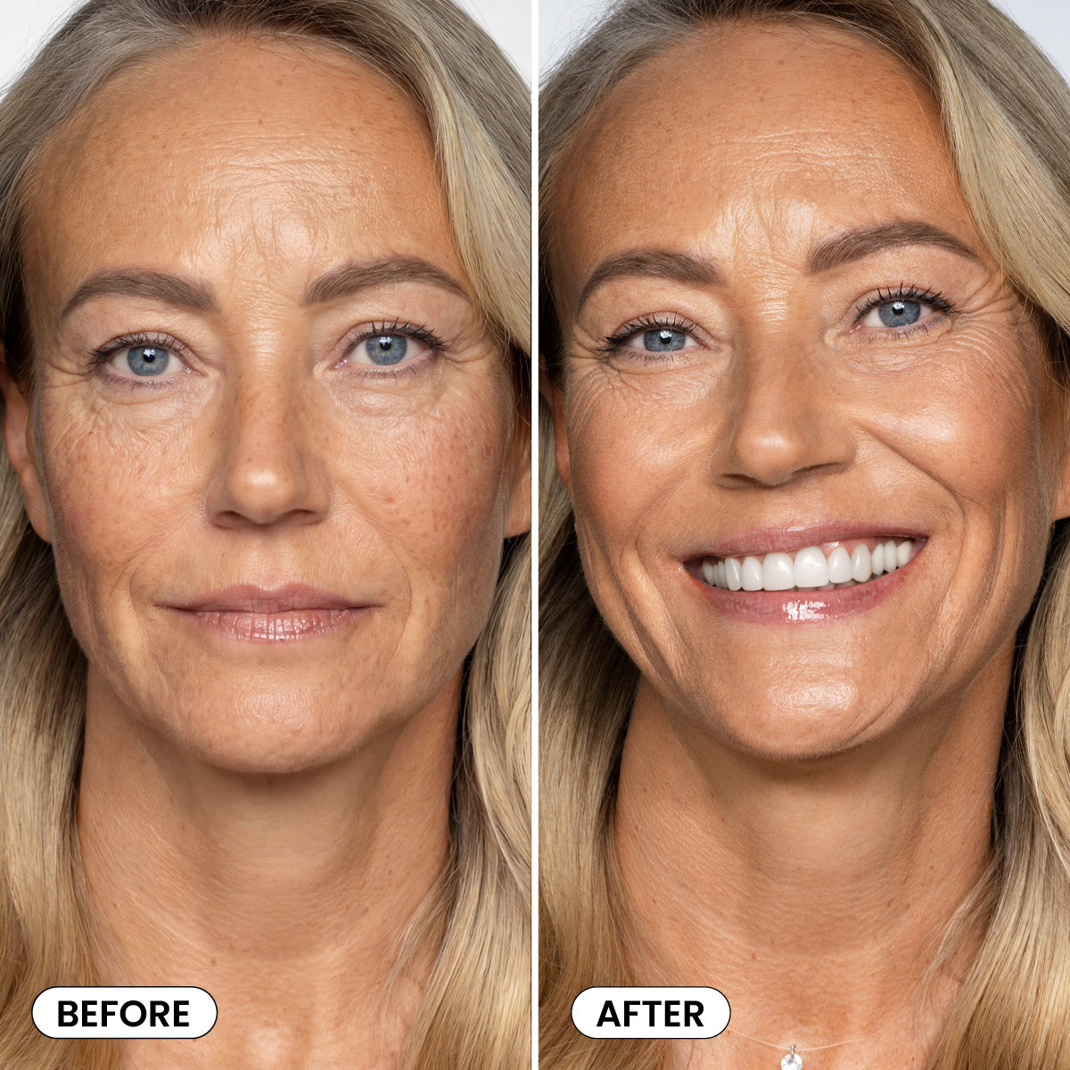 Side-by-side photos of a middle-aged woman: left shows wrinkles and neutral expression (Before); right shows her smiling with smoother skin and brighter teeth (After) after using PrimePrometics™ Hollywood Glow Set.
