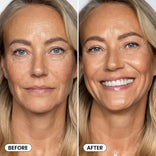 Side-by-side photos of a middle-aged woman: left shows wrinkles and neutral expression (Before); right shows her smiling with smoother skin and brighter teeth (After) after using PrimePrometics™ Hollywood Glow Set.