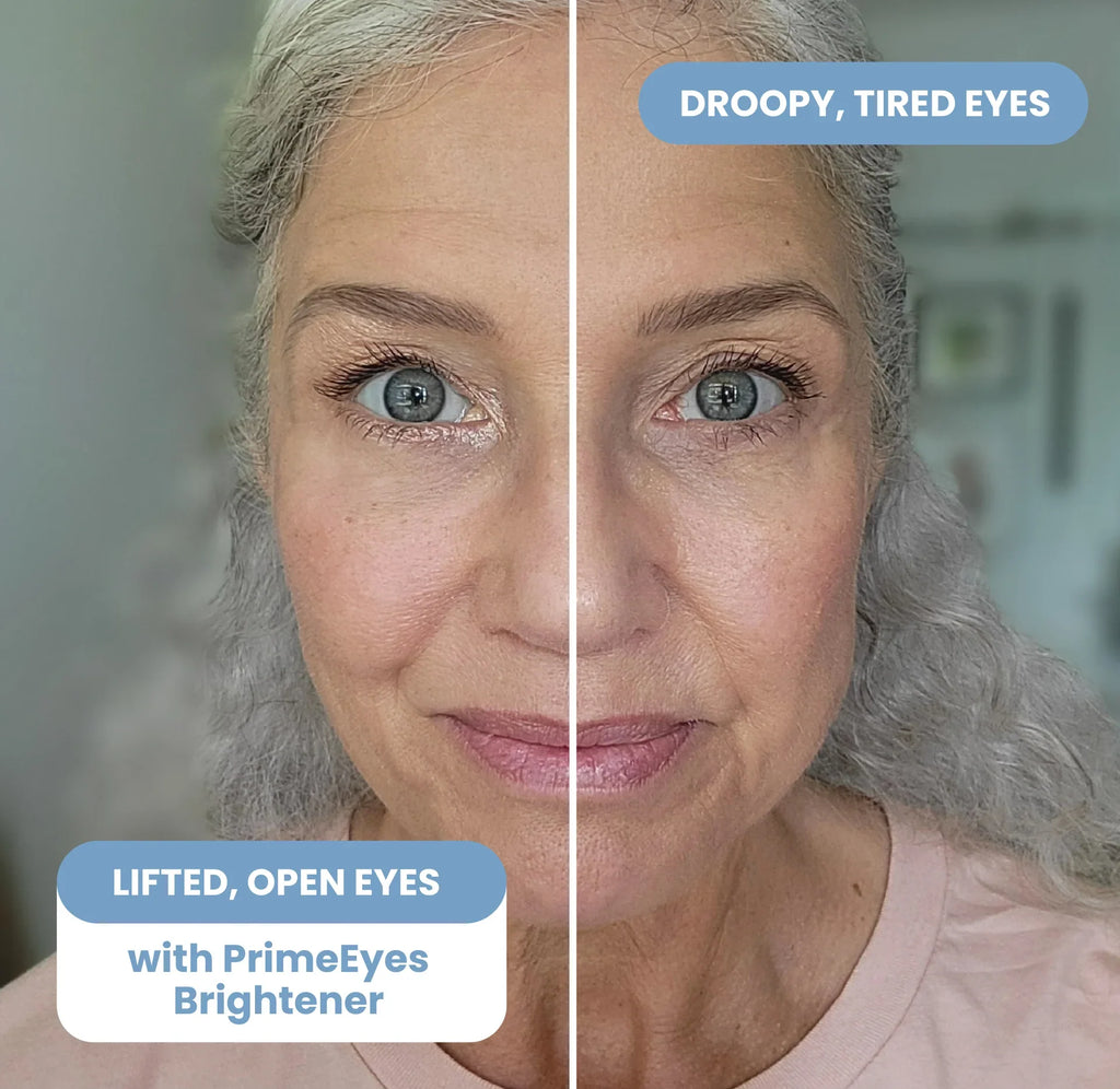 Before-and-after of a mature woman with droopy tired eyes becoming lifted and open with Prime Prometics PrimeEyes Brightener