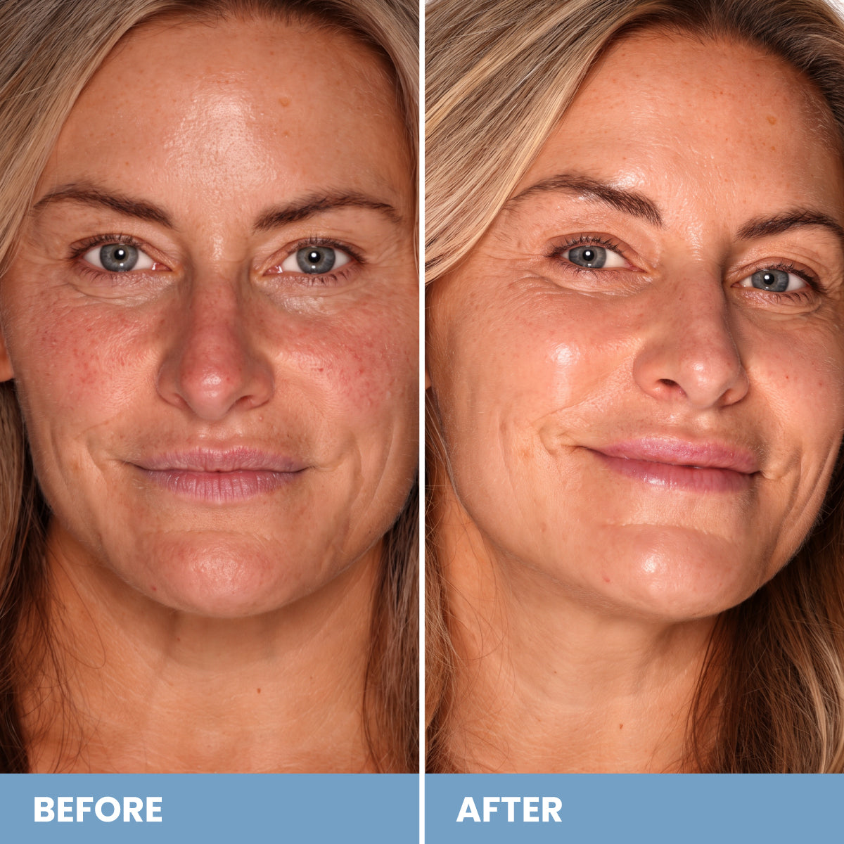 Before and after comparison of a woman’s face, showing reduced skin redness and a smoother, luminous complexion after applying the PrimePrometics™ No Touch-Ups Needed Duo.