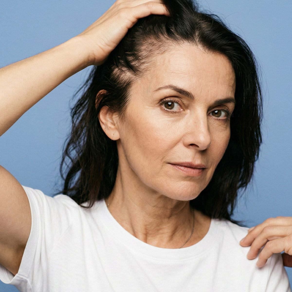 A middle-aged woman with dark hair and a white t-shirt holds up her hair to reveal thinning near her hairline, standing against a blue background.