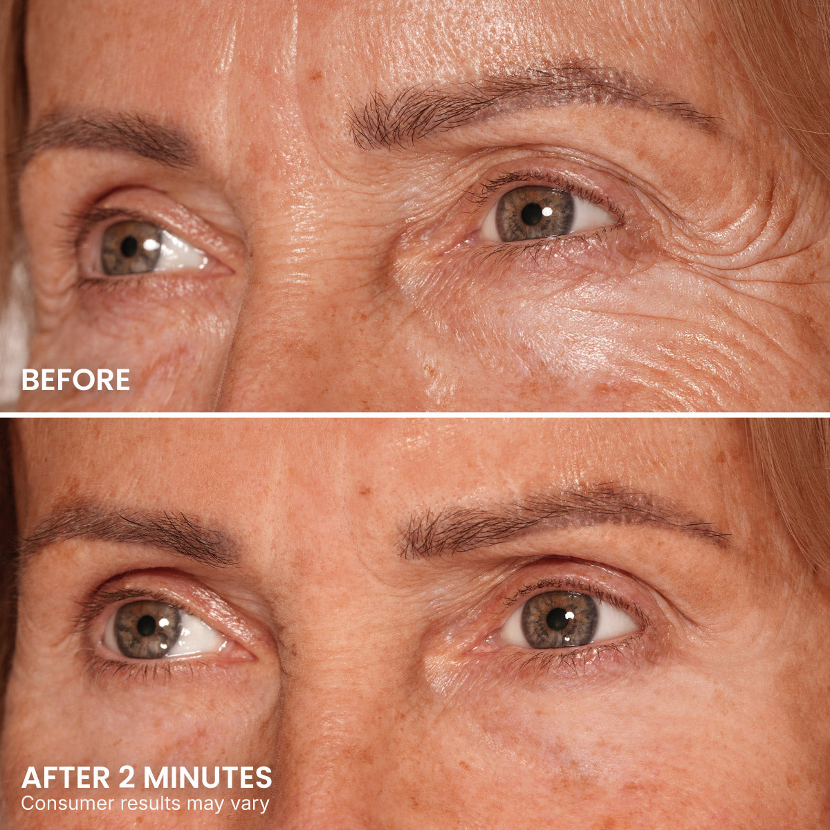 Close-up of a person’s eye area showing Before with visible wrinkles, fine lines, and under-eye bags, and After 2 Minutes after applying PrimeLift Instant Eye Tightener by PrimePrometics™, revealing smoother skin and fewer wrinkles. Text notes: Consumer results may vary.