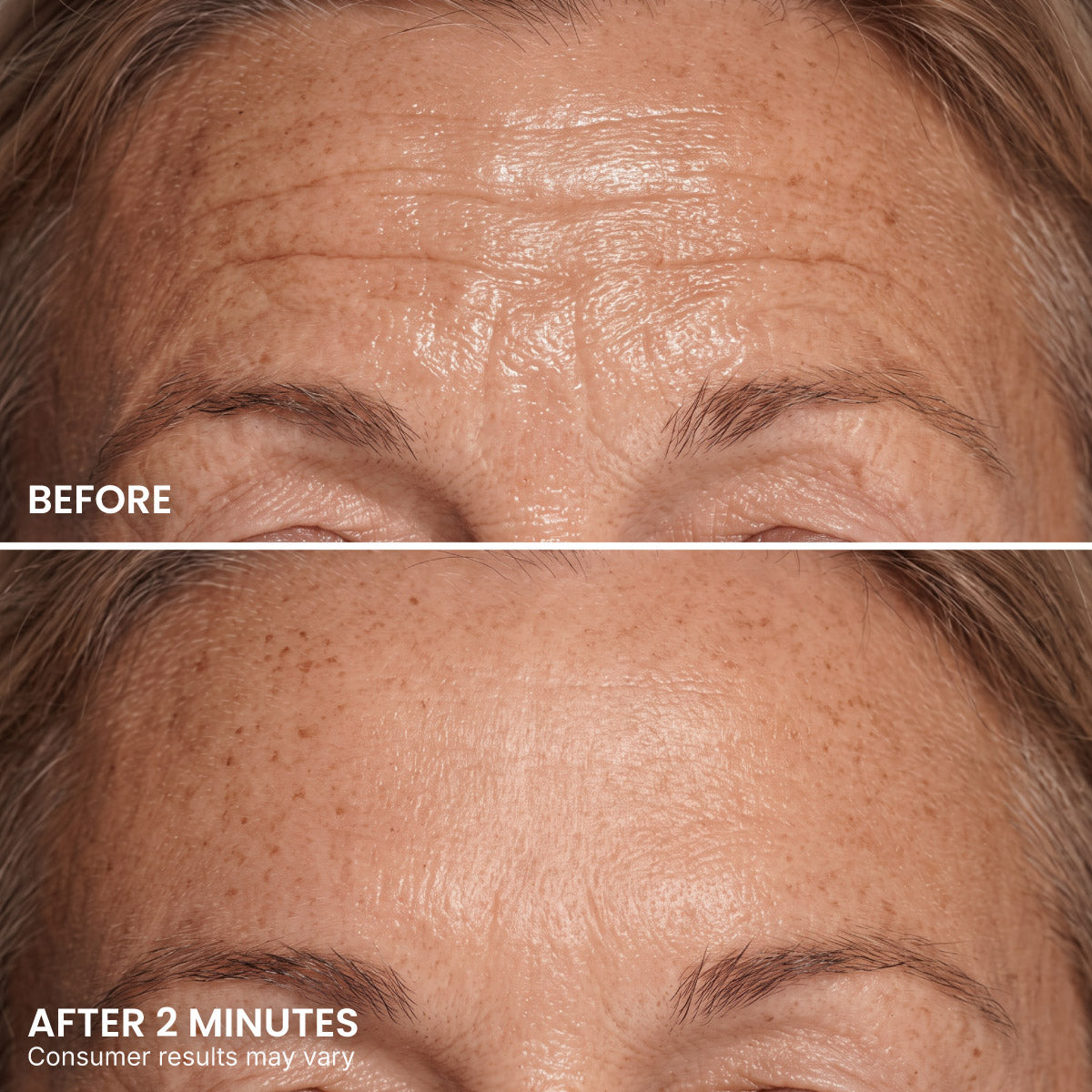 Close-up of a person’s forehead showing deep wrinkles and fine lines in the “before” image, with noticeably smoother skin and reduced wrinkles just 2 minutes after applying PrimePrometics™ PrimeLift Instant Eye Tightener. Text notes that consumer results may vary.