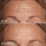 Close-up of a person’s forehead showing deep wrinkles and fine lines in the “before” image, with noticeably smoother skin and reduced wrinkles just 2 minutes after applying PrimePrometics™ PrimeLift Instant Eye Tightener. Text notes that consumer results may vary.