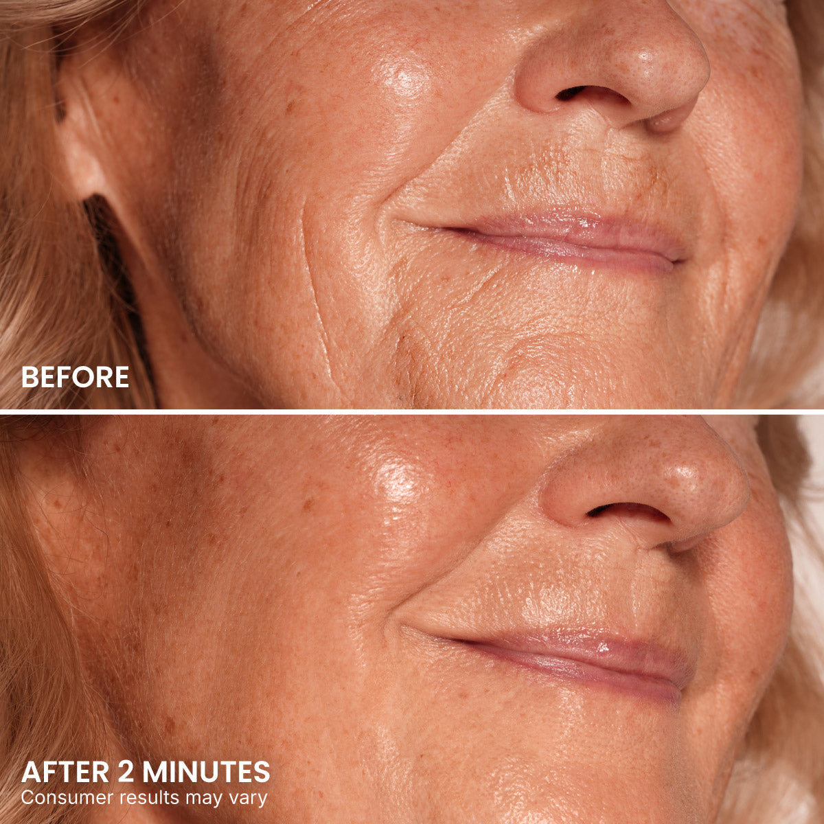 Close-up of a woman’s lower face shows smoother skin and reduced fine lines in the “after 2 minutes” image after using PrimePrometics™ PrimeLift Instant Eye Tightener, compared to more visible wrinkles in the “before” image; text notes results may vary.