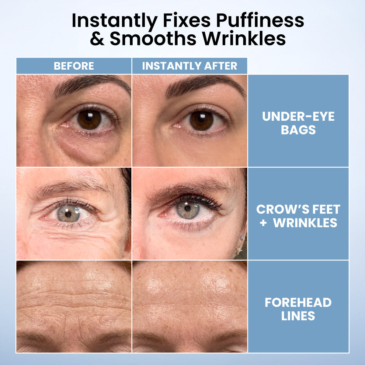 A comparison shows before-and-after close-ups of eyes and forehead, highlighting reduced under-eye bags, fine lines, crow’s feet, wrinkles, and forehead lines after using PrimePrometics™ PrimeLift Instant Eye Tightener.