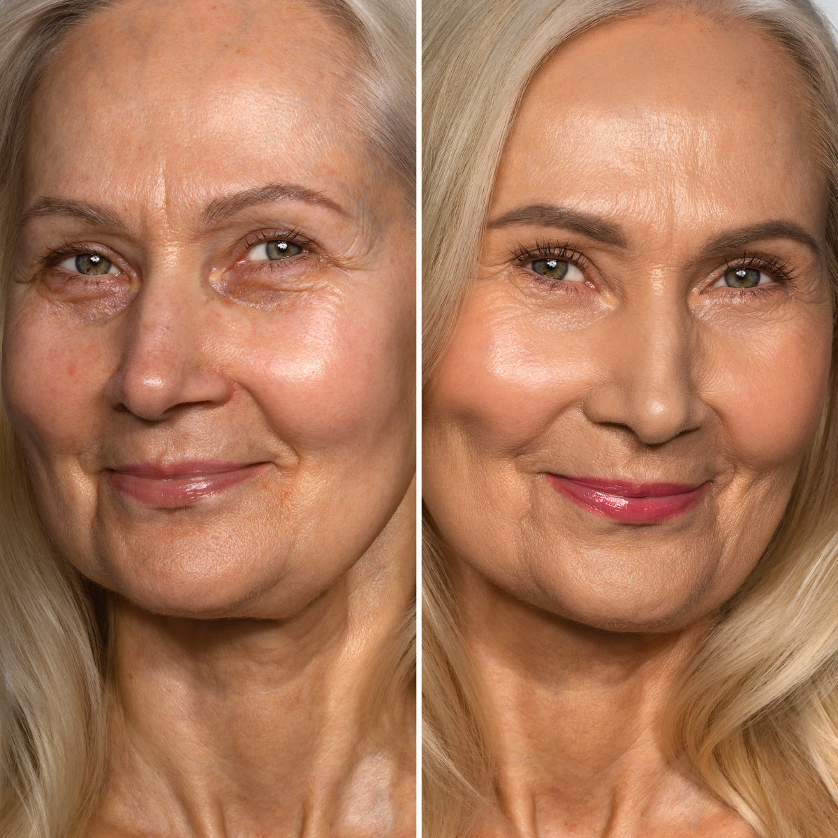 Side-by-side comparison of an older woman with long blonde hair; left side shows her face with natural skin, right side shows her with smoother skin and makeup for a rejuvenated look.
