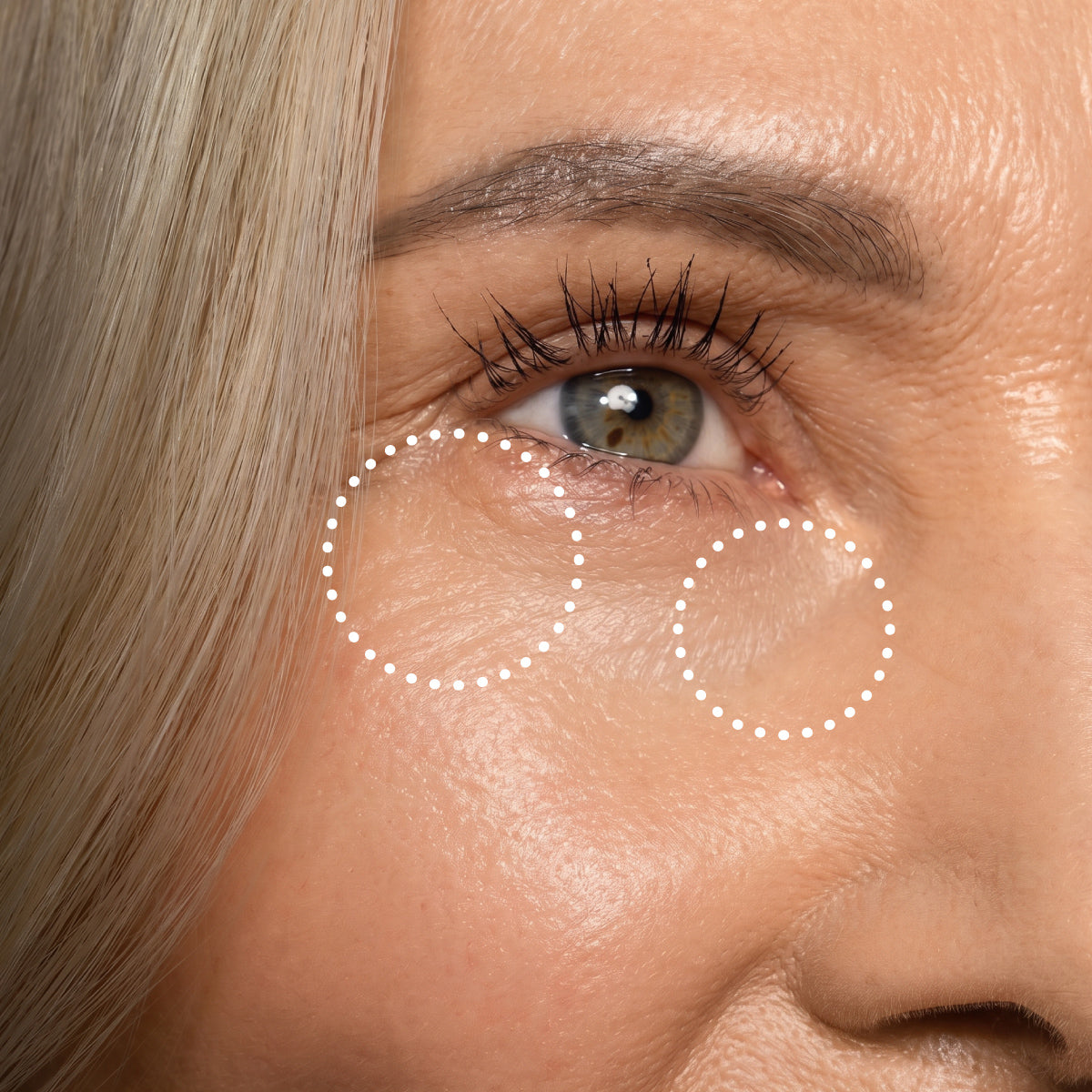 Close-up of a mature persons right eye, showing smooth skin with two dotted circles highlighting the area under the eye and at the outer corner, possibly indicating focus on wrinkles or skincare.