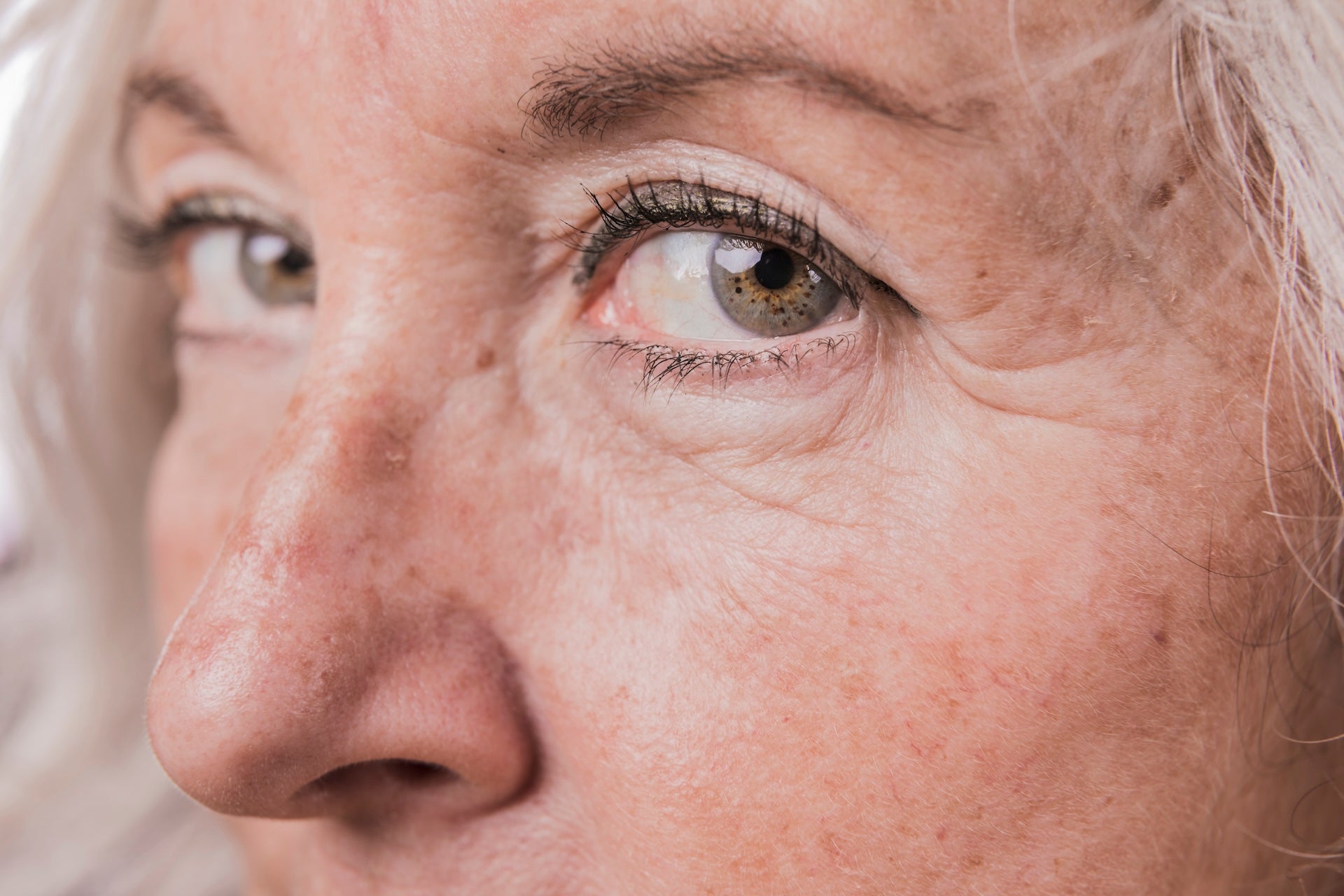 Close-up of an older persons face, focusing on the eyes, nose, and skin texture. The skin shows visible wrinkles, freckles, and fine lines, and the hair appears white or gray.