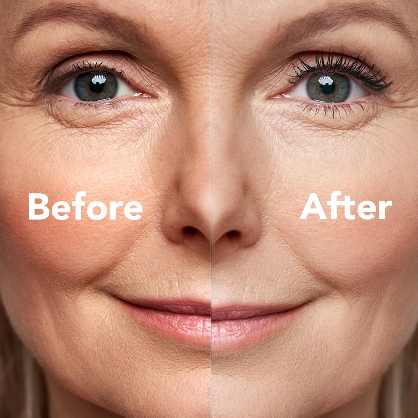 A split image of a womans face labeled Before and After, showing reduced wrinkles, smoother skin, and brighter complexion on the After side compared to the Before side.